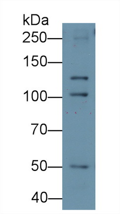 Monoclonal Antibody to Desmoglein 3 (DSG3)