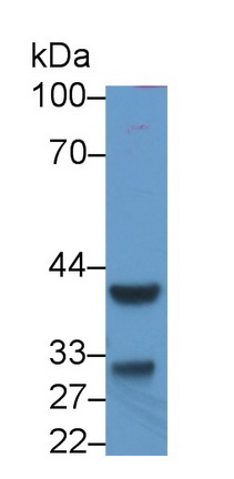 Monoclonal Antibody to Inhibin Beta C (INHbC)