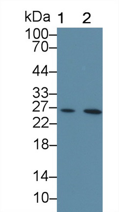 Monoclonal Antibody to Cardiac Troponin I (cTnI)