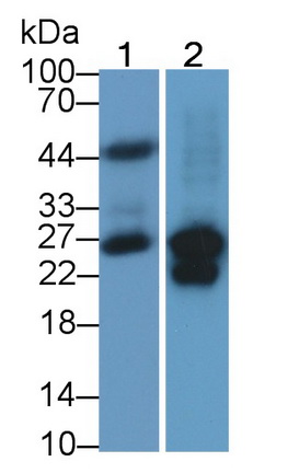 Monoclonal Antibody to Cardiac Troponin I (cTnI)