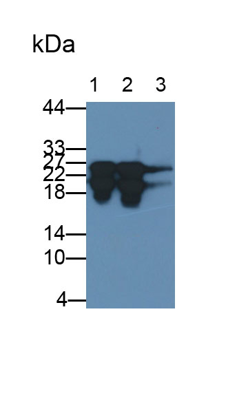 Monoclonal Antibody to Cardiac Troponin I (cTnI)