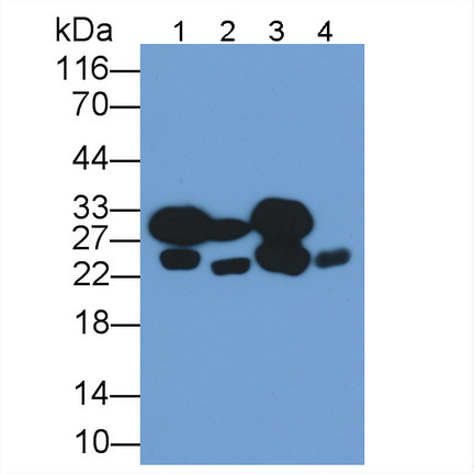 Monoclonal Antibody to Cardiac Troponin I (cTnI)