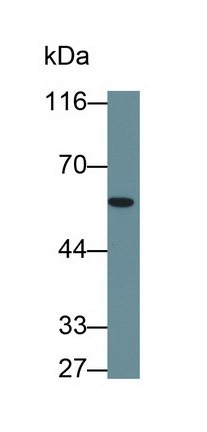 Monoclonal Antibody to Lymphotoxin Beta Receptor (LTbR)