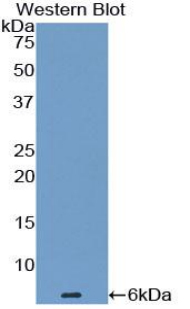 Monoclonal Antibody to Endothelin 1 (EDN1)