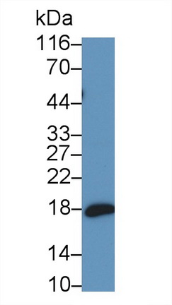 Monoclonal Antibody to N-Terminal Pro-Atrial Natriuretic Peptide (NT-ProANP)