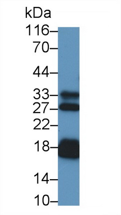 Monoclonal Antibody to N-Terminal Pro-Atrial Natriuretic Peptide (NT-ProANP)