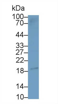 Monoclonal Antibody to N-Terminal Pro-Brain Natriuretic Peptide (NT-ProBNP)