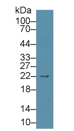 Monoclonal Antibody to N-Terminal Pro-Brain Natriuretic Peptide (NT-ProBNP)