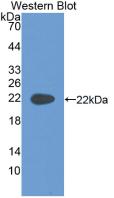 Monoclonal Antibody to Cytokeratin 4 (CK4)