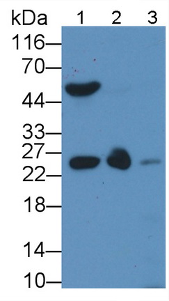 Monoclonal Antibody to Apolipoprotein A1 (APOA1)