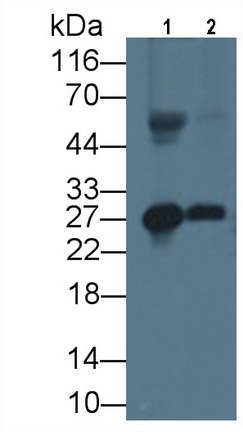 Monoclonal Antibody to Apolipoprotein A1 (APOA1)