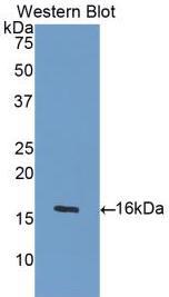 Monoclonal Antibody to Platelet Derived Growth Factor AA (PDGFAA)