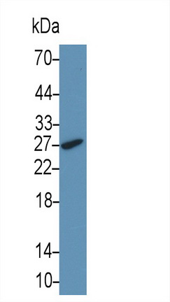 Monoclonal Antibody to Tissue Factor (TF)