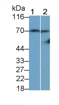 Monoclonal Antibody to Tissue Plasminogen Activator (tPA)