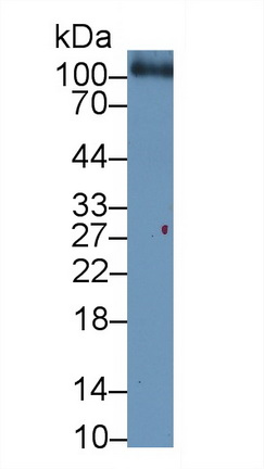 Monoclonal Antibody to Thrombomodulin (TM)