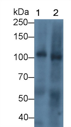 Monoclonal Antibody to Thrombomodulin (TM)