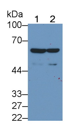 Monoclonal Antibody to Thrombomodulin (TM)