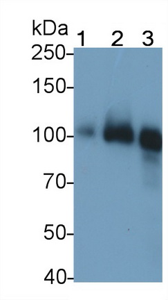 Monoclonal Antibody to Thrombomodulin (TM)