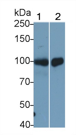 Monoclonal Antibody to Thrombomodulin (TM)