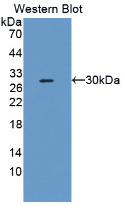 Monoclonal Antibody to Plasminogen Activator Inhibitor 2 (PAI2)