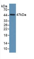 Monoclonal Antibody to Plasminogen Activator Inhibitor 1 (PAI1)