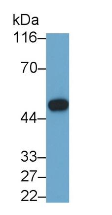 Monoclonal Antibody to Plasminogen Activator Inhibitor 1 (PAI1)