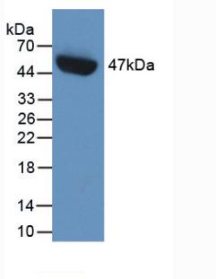 Monoclonal Antibody to Plasminogen Activator Inhibitor 1 (PAI1)