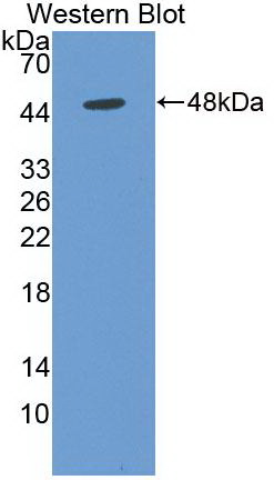 Monoclonal Antibody to Enolase, Neuron Specific (NSE)