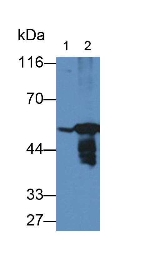 Monoclonal Antibody to Enolase, Neuron Specific (NSE)