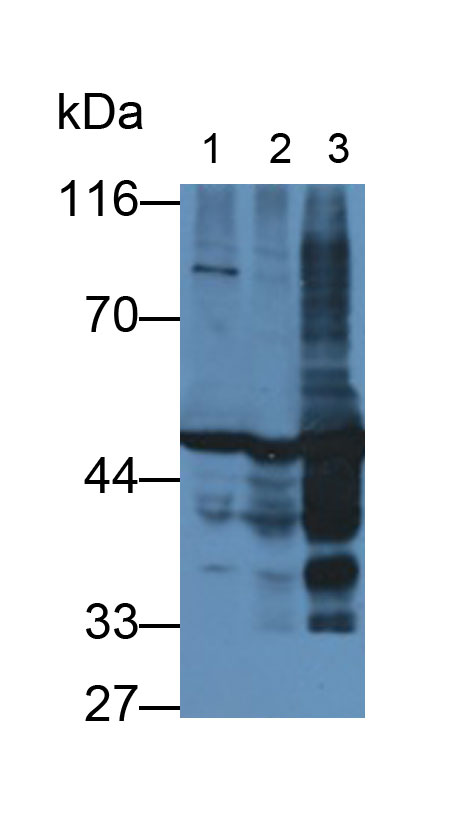 Monoclonal Antibody to Enolase, Neuron Specific (NSE)