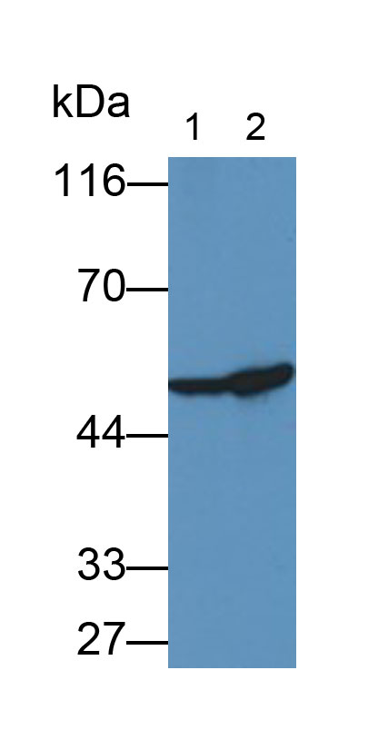 Monoclonal Antibody to Enolase, Neuron Specific (NSE)