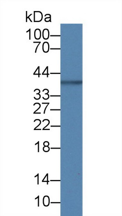 Monoclonal Antibody to Myelin Basic Protein (MBP)