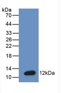 Monoclonal Antibody to Brain Natriuretic Peptide (BNP)