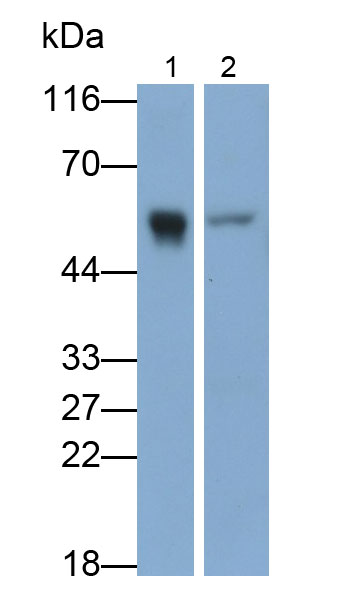 Monoclonal Antibody to Immunoglobulin G (IgG)