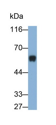 Monoclonal Antibody to Immunoglobulin G (IgG)