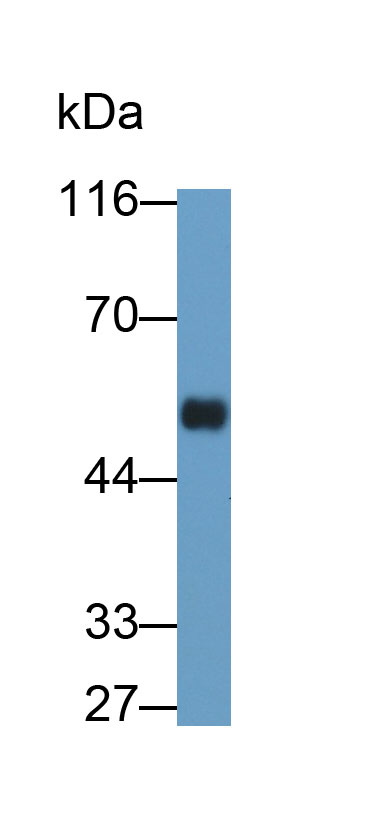 Monoclonal Antibody to Immunoglobulin G (IgG)