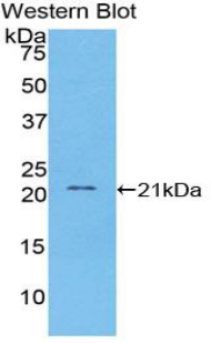 Monoclonal Antibody to Vascular Cell Adhesion Molecule 1 (VCAM1)