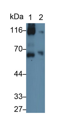 Monoclonal Antibody to Vascular Cell Adhesion Molecule 1 (VCAM1)