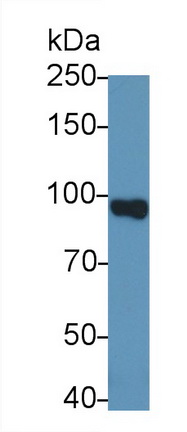 Monoclonal Antibody to Vascular Cell Adhesion Molecule 1 (VCAM1)