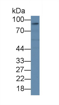 Monoclonal Antibody to Intercellular Adhesion Molecule 1 (ICAM1)