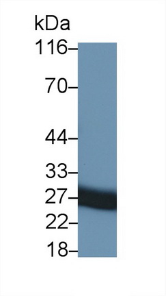 Monoclonal Antibody to Tissue Inhibitors Of Metalloproteinase 1 (TIMP1)