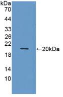 Monoclonal Antibody to Matrix Metalloproteinase 9 (MMP9)