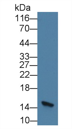 Monoclonal Antibody to Fatty Acid Binding Protein 2, Intestinal (FABP2)