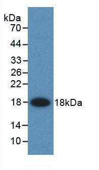 Monoclonal Antibody to Fatty Acid Binding Protein 2, Intestinal (FABP2)