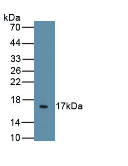 Monoclonal Antibody to Epidermal Growth Factor (EGF)