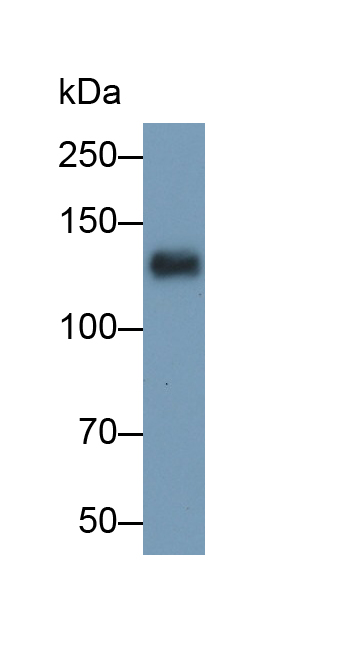 Monoclonal Antibody to Epidermal Growth Factor (EGF)