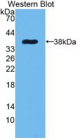 Monoclonal Antibody to Epidermal Growth Factor (EGF)