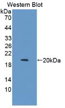 Monoclonal Antibody to Interleukin 1 Beta (IL1b)