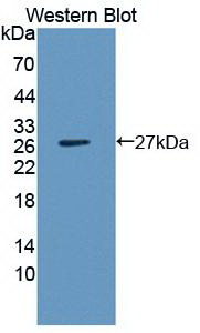 Monoclonal Antibody to Interleukin 1 Beta (IL1b)