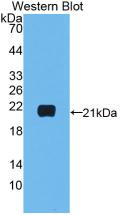 Monoclonal Antibody to Interleukin 1 Beta (IL1b)